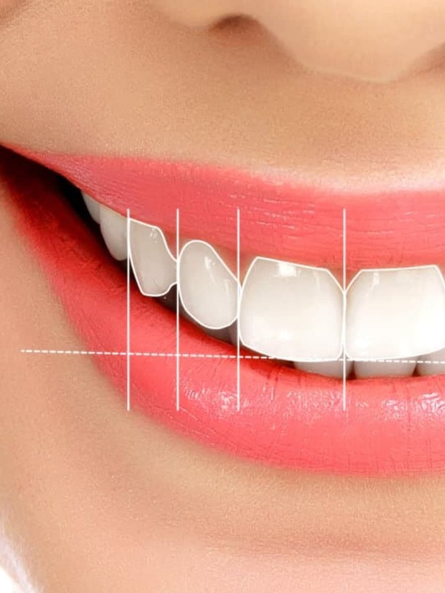 Gülüş tasarımı planlaması yapılan modern klinik ortamı